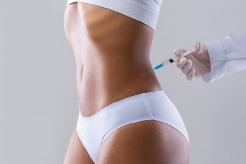 Lipoliza vam daje mogućnost da reoblikujete svoje telo