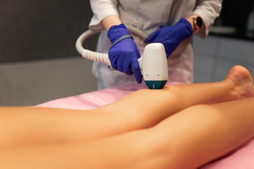 Sa našim laserom dlake nestaju zauvek