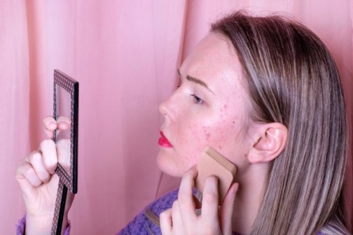 Kako skinuti fleke od bubuljica sa lica?