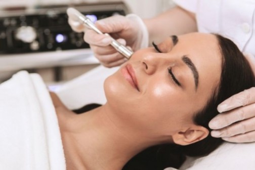 Mikrodermoabrazija  - dijamantima do blistave kože